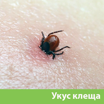 Укус клеща в Мичуринске